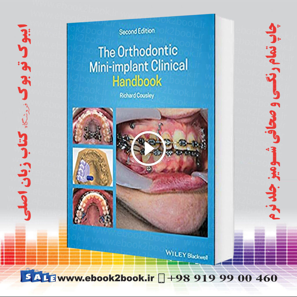 The Orthodontic Mini-implant Clinical Handbook 2nd Edition