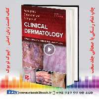 Fitzpatrick’s Color Atlas and Synopsis of Clinical Dermatology