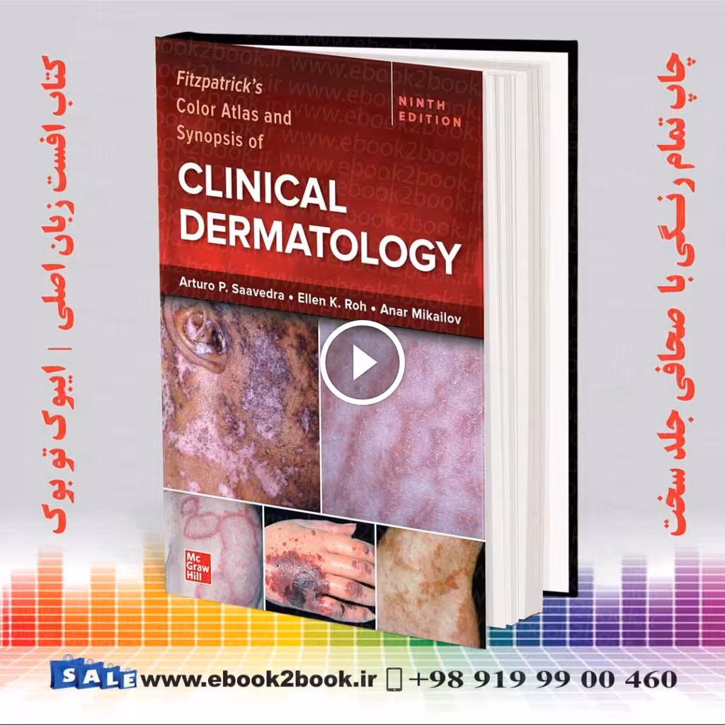 Fitzpatrick’s Color Atlas and Synopsis of Clinical Dermatology