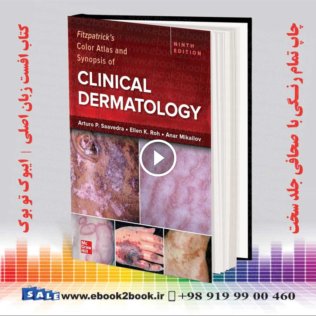 Fitzpatrick’s Color Atlas and Synopsis of Clinical Dermatology