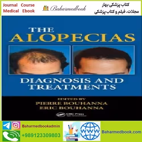 The Alopecias Diagnosis and Treatments TRUE PDF price 1€ - کتاب پزشکی بهار