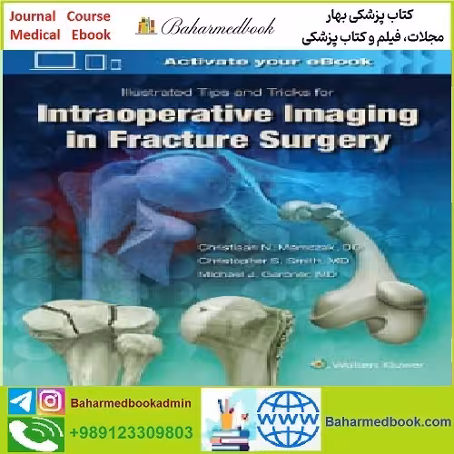 Illustrated Tips and Tricks for Intraoperative Imaging in Fracture S