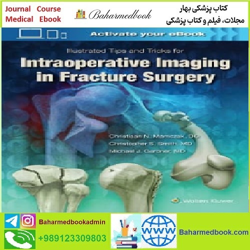Illustrated Tips and Tricks for Intraoperative Imaging in Fracture S