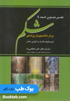 تفسیر تصاویر اشعه ایکس شکم برای دانشجویان پزشکی