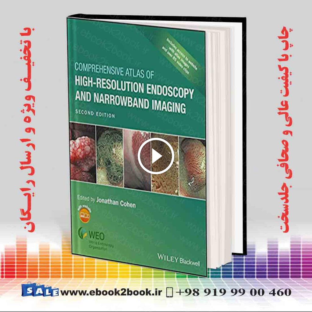 Comprehensive Atlas of High-Resolution Endoscopy and Narrowband Imaging 2nd Edition