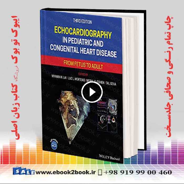 Echocardiography in Pediatric and Congenital Heart Disease 3rd Edition