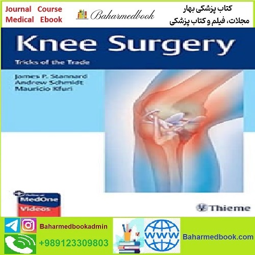 Knee Surgery Tricks of the Trade TRUE PDF price 1€ - کتاب پزشکی بهار