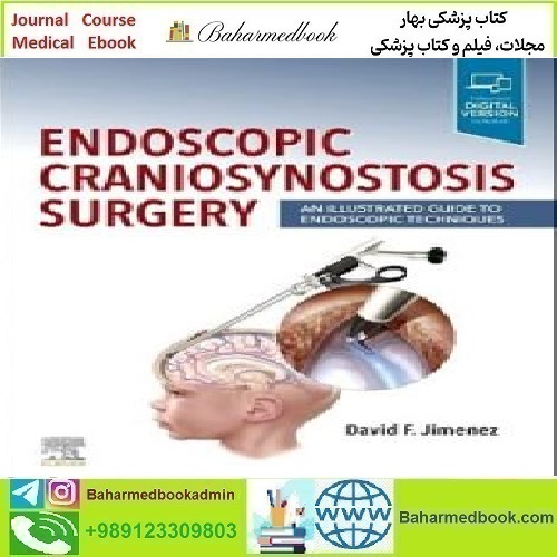 Endoscopic Craniosynostosis Surgery 2023 TRUE PDF price 2€ - کتاب پزشکی بهار