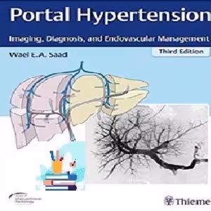 Portal Hypertension Imaging Diagnosis and Endovascular Mana