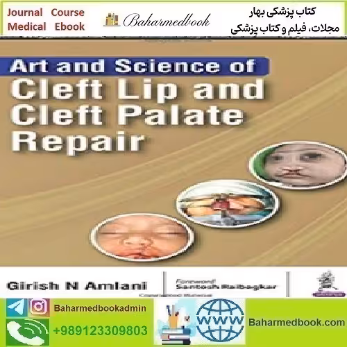 Art and Science of Cleft Lip and Cleft Palate Repai