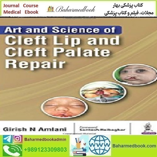 Art and Science of Cleft Lip and Cleft Palate Repai
