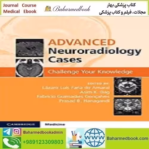 Advanced Neuroradiology Cases Challenge Your Knowledge 20