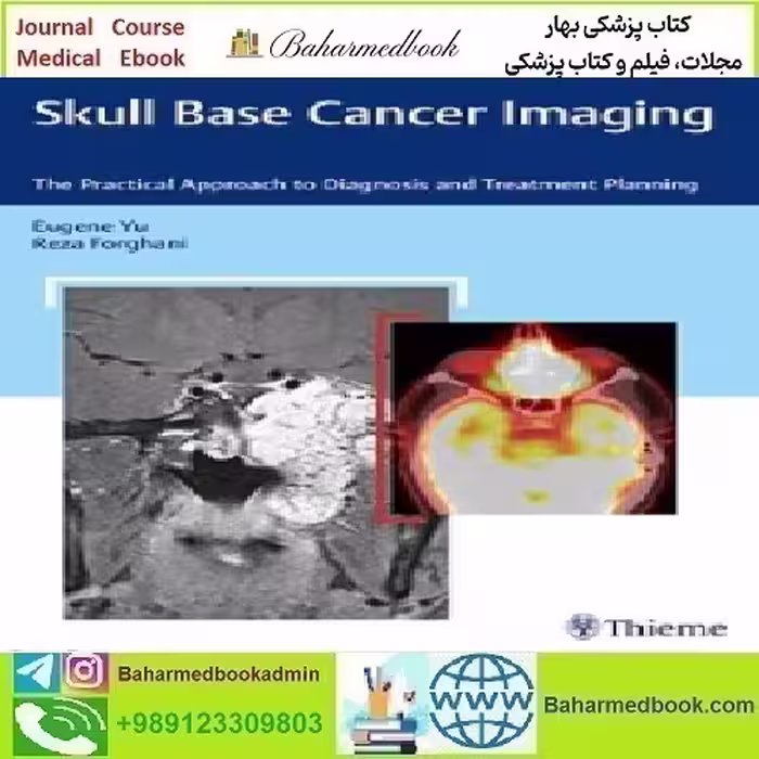 Skull Base Cancer Imaging The Practical Approach to Diagnosis