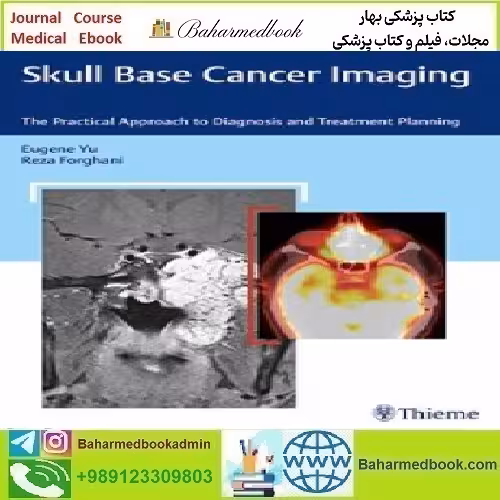 Skull Base Cancer Imaging The Practical Approach to Diagnosis