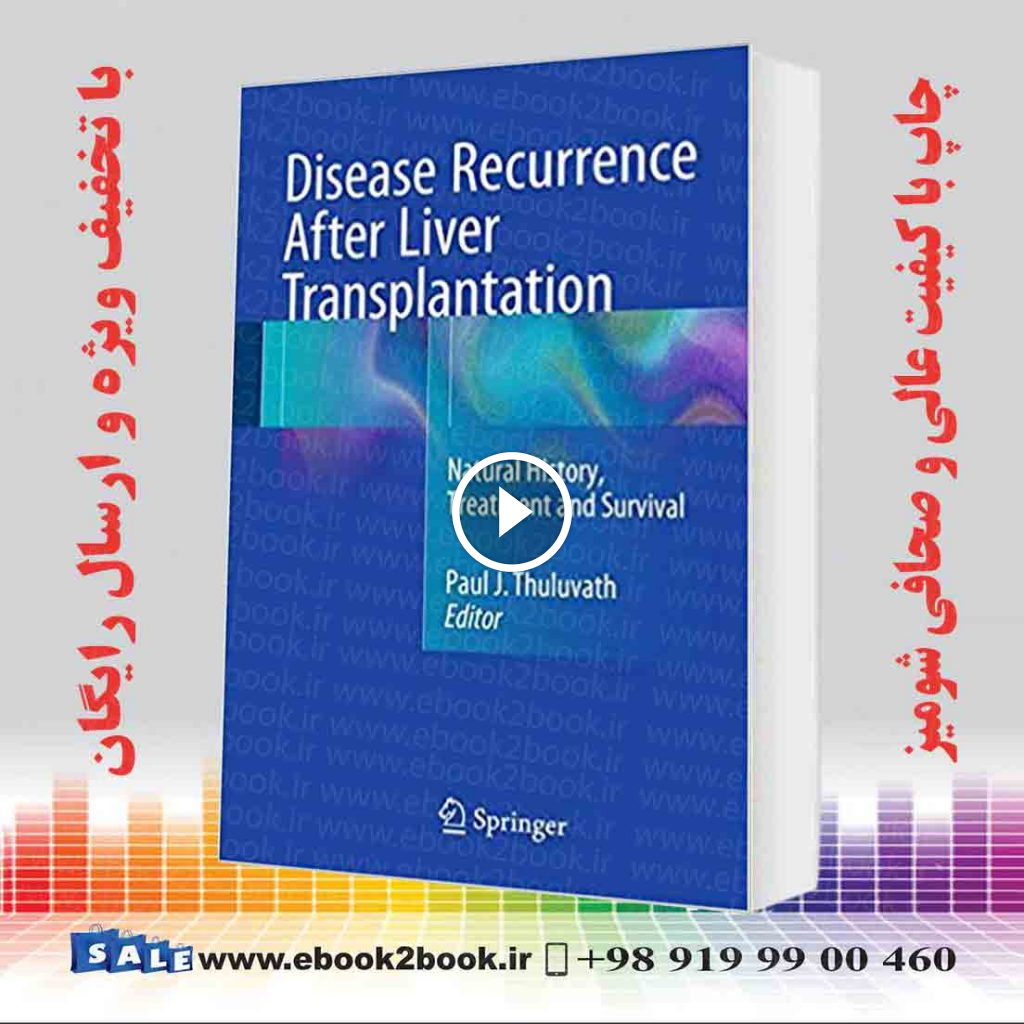 Disease Recurrence After Liver Transplantation