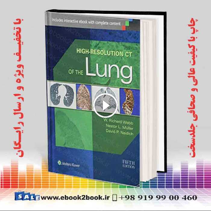 High-Resolution CT of the Lung Fifth Edition