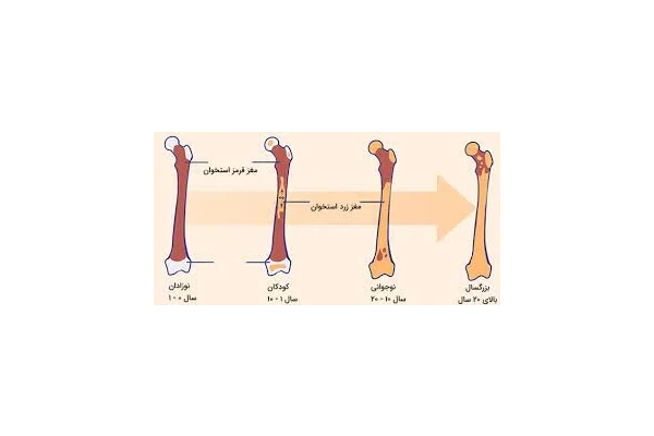 فایل سندرم نارسایی مغز استخوان - کتابخانه مجازی واتیکان