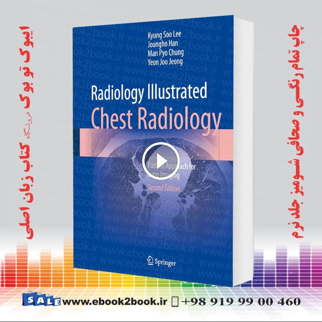Radiology Illustrated: Chest Radiology: Pattern Approach for Lung Imaging Second Edition