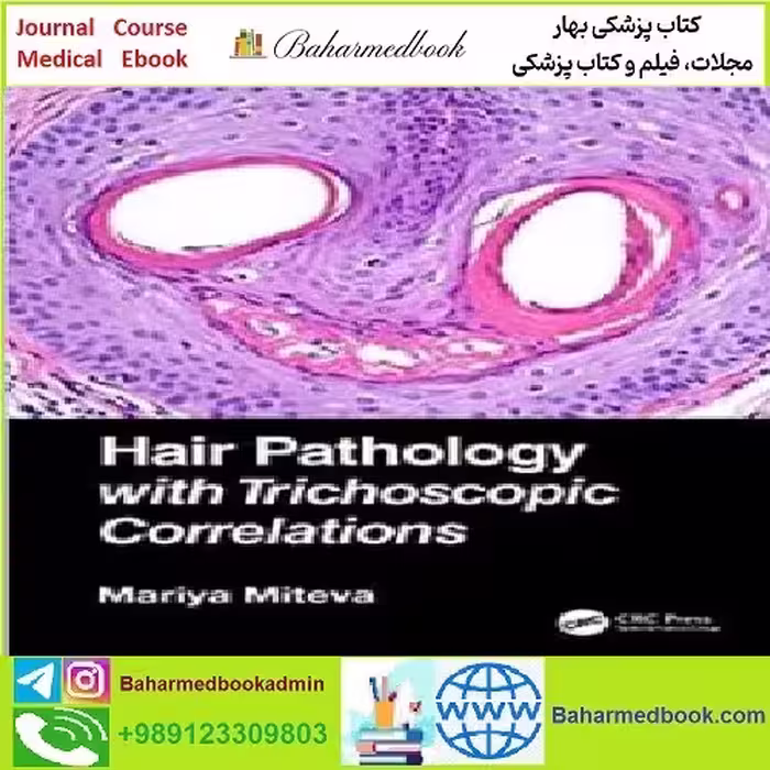 Hair Pathology with Trichoscopic Correlations TRUE PDF price 1€ - کتاب پزشکی بهار