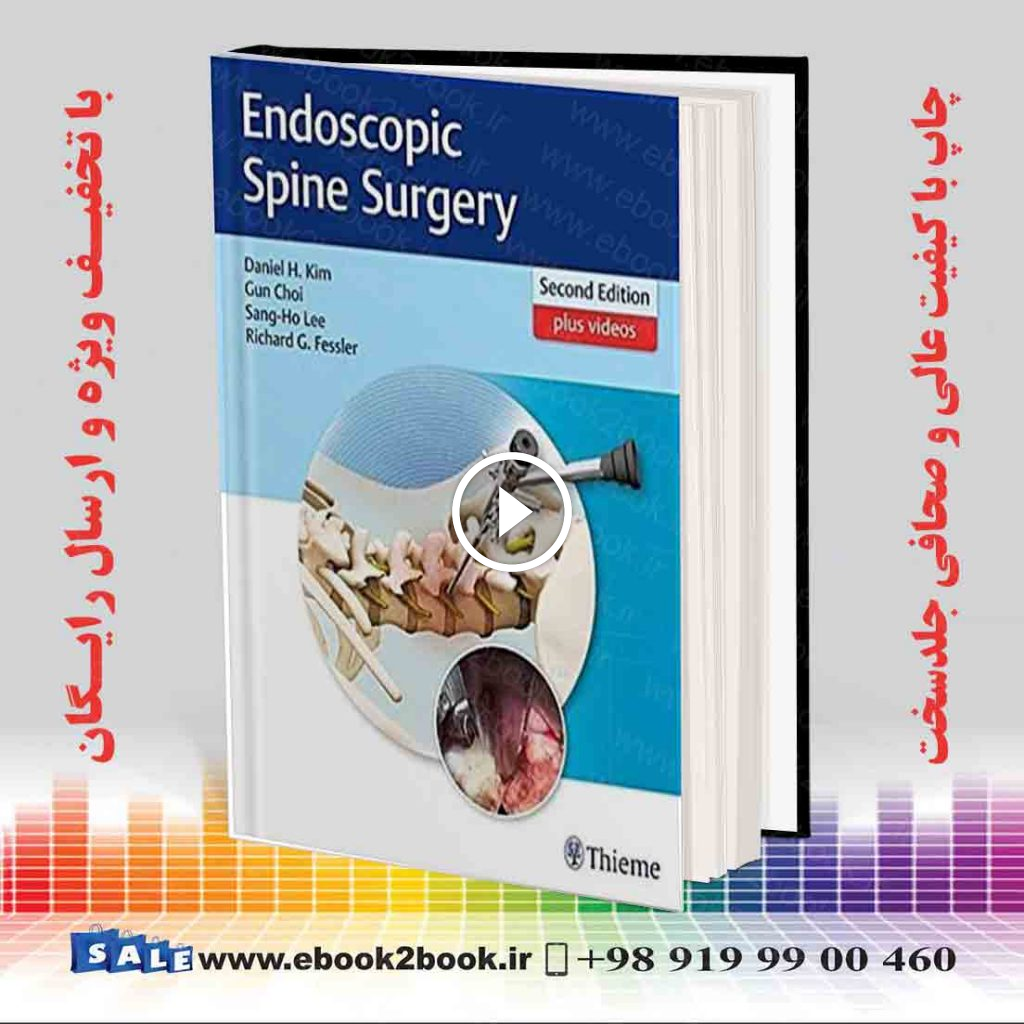 Endoscopic Spine Surgery 2nd Edition