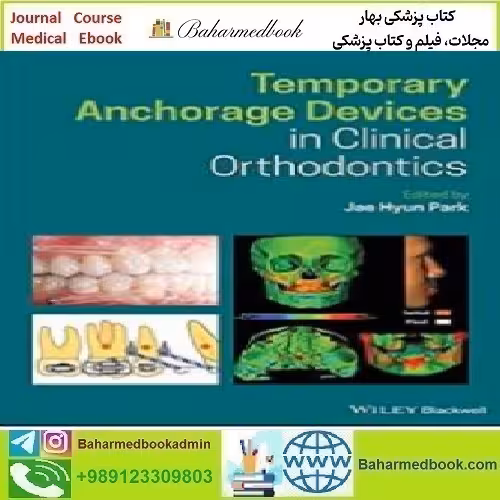 Temporary Anchorage Devices in Clinical Orthodontics 2020 TRU