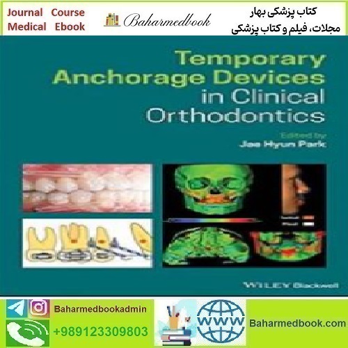 Temporary Anchorage Devices in Clinical Orthodontics 2020 TRU