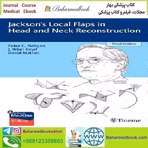 Jackson's Local Flaps in Head and Neck Reconstruction Video
