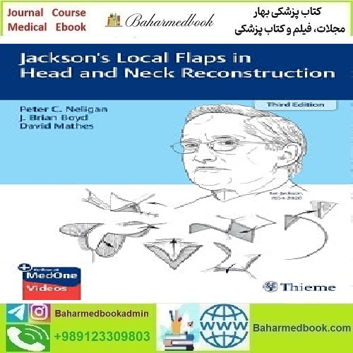 Jackson&#039;s Local Flaps in Head and Neck Reconstruction Video