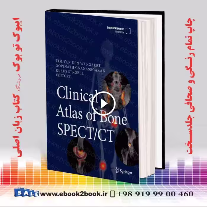Clinical Atlas of Bone SPECT/CT