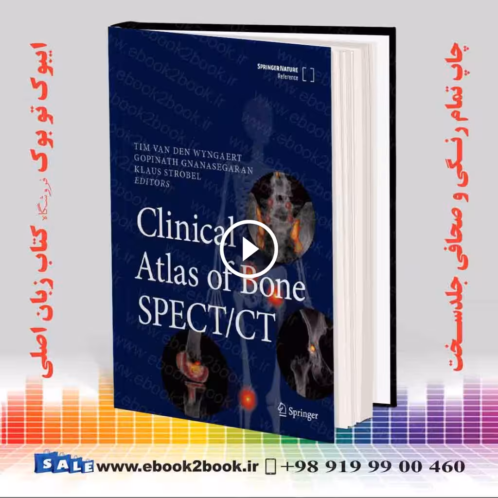 Clinical Atlas of Bone SPECT/CT