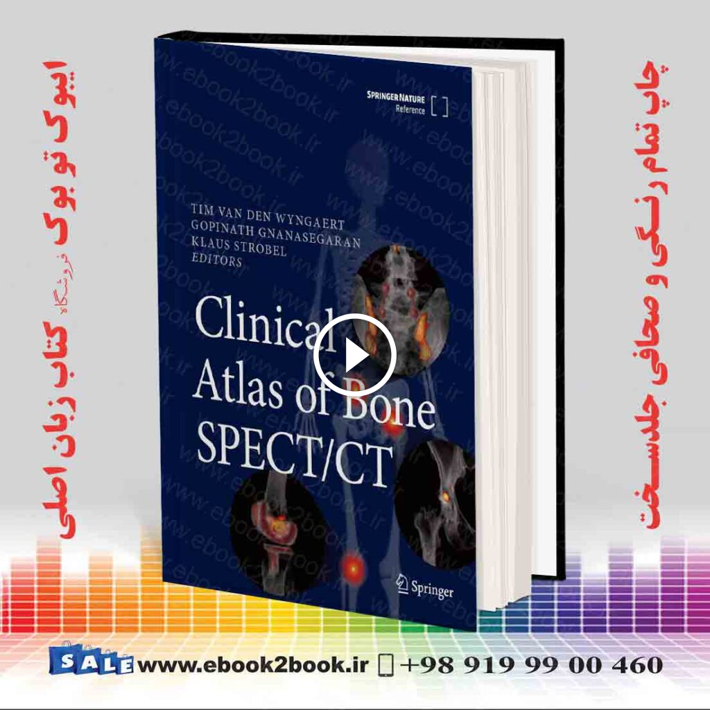 Clinical Atlas of Bone SPECT/CT
