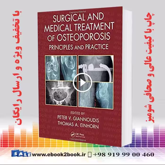 Surgical and Medical Treatment of Osteoporosis