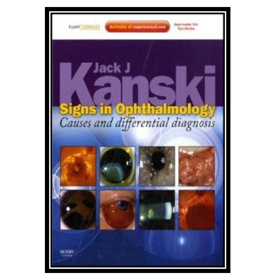 کتاب Signs in Ophthalmology اثر Jack J Kanski انتشارات مؤلفین طلایی