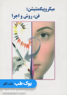 میکروپیگنتیشن فن، روش و اجرا
