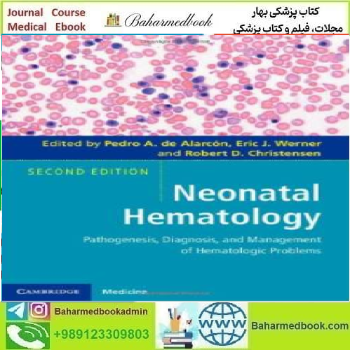 Neonatal Hematology Pathogenesis Diagnosis and Management