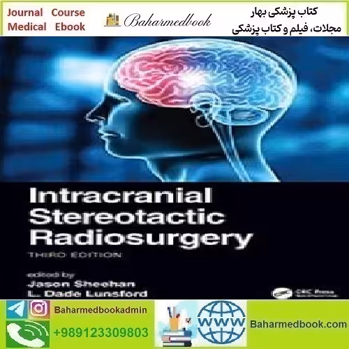 Intracranial Stereotactic Radiosurgery 2022 TRUE PDF price 1€ - کتاب پزشکی بهار