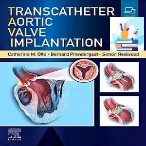 Transcatheter Aortic Valve Implantation TRUE PDF   VIDEOS Price 9€