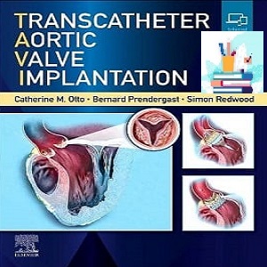 Transcatheter Aortic Valve Implantation TRUE PDF VIDEOS Price 9€