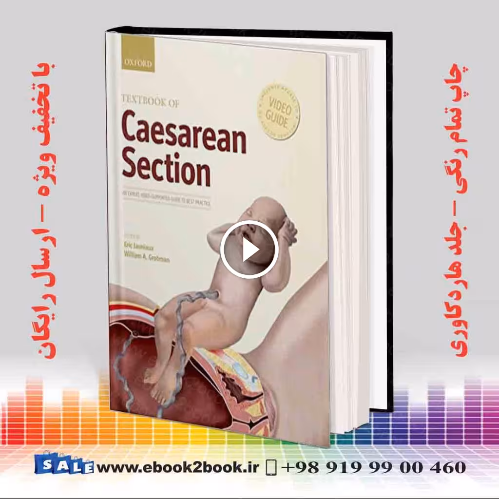 Textbook of Caesarean Section