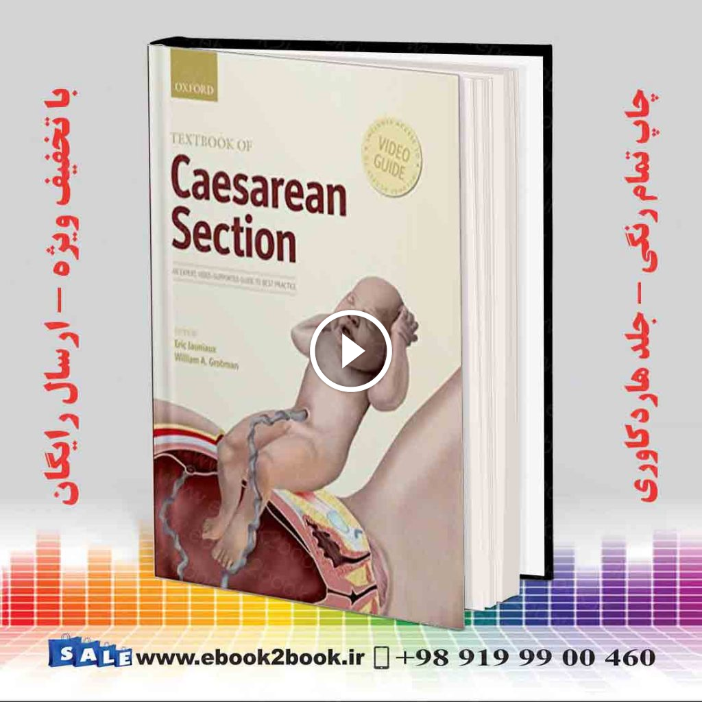 Textbook of Caesarean Section