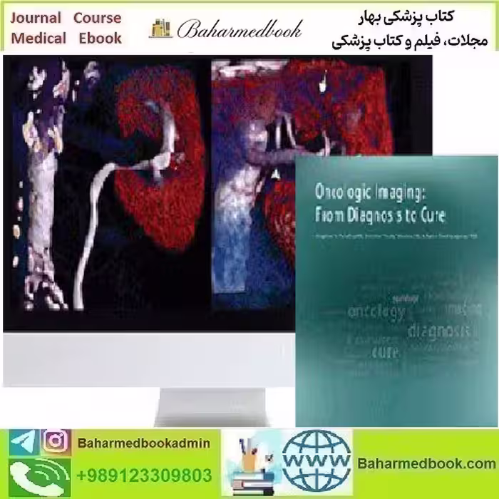 ARRS Oncologic Imaging From Diagnosis to Cure 2016 video c