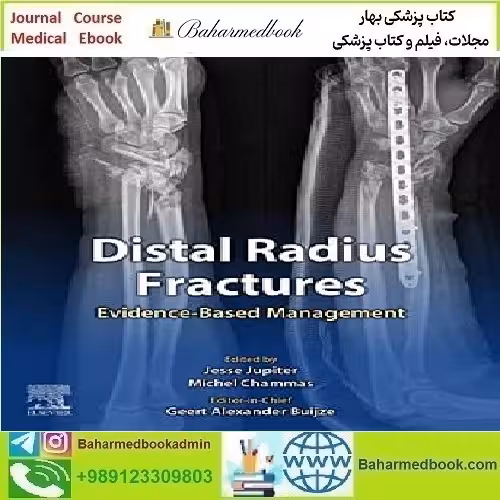 Distal Radius Fractures Evidence Based Management Video 2021