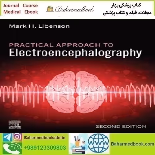 Practical Approach to Electroencephalography 2025