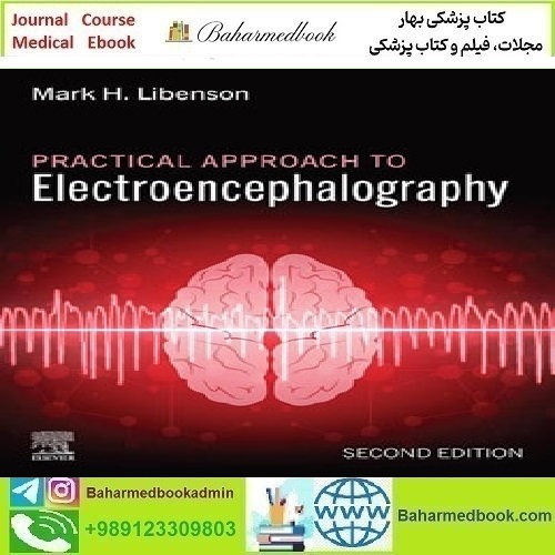 Practical Approach to Electroencephalography 2025