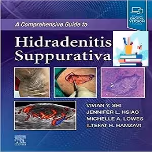 BAHARMEDBOOK Comprehensive Guide to Hidradenitis Suppurativa