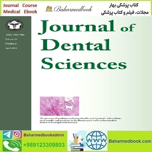 Journal of Dental Sciences Volume 19 Issue 1 to 2 2024 TR