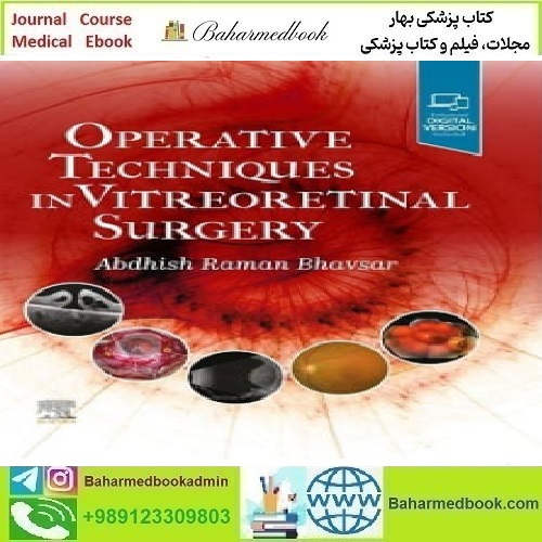 Operative Techniques in Vitreoretinal Surgery 2023