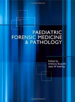 [PDF] دانلود کتاب Paediatric Forensic Medicine And Pathology, 2008