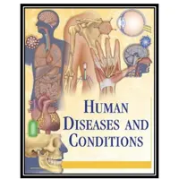 کتاب Human Diseases and Conditions اثر Miranda Herbert Ferrara انتشارات مؤلفین طلایی