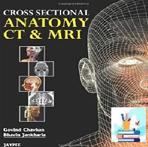 Cross Sectional Anatomy CT & MRI True PDF price 1€